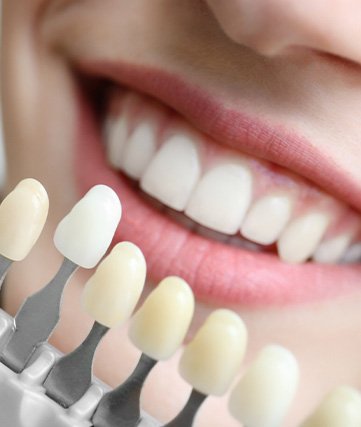 Closeup of shade guide held next to someone’s teeth